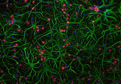 An image of neurons, astrocytes, and other glial cells acquired using fluorescence microscopy. An image of neurons, astrocytes, and other glial cells acquired using fluorescence microscopy.